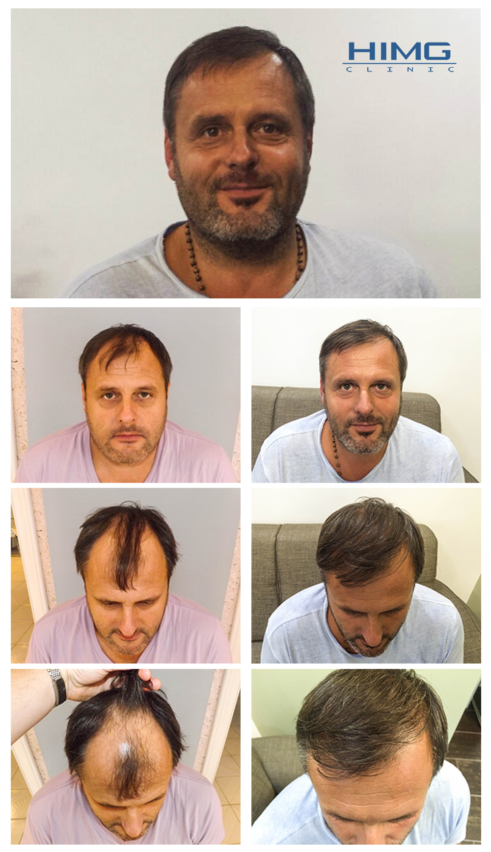 k-mihaly-hajbeultetes-elott-utan