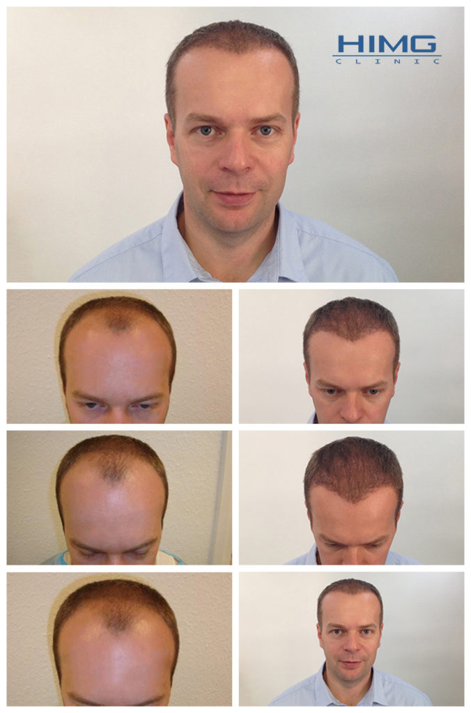 lajtos-tamas-hajbeultetes-elott-utan1