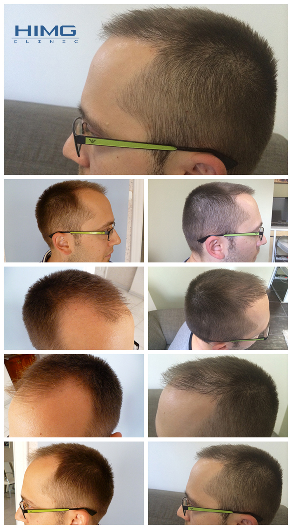 p-aron-hajbeultetes-elott-utan