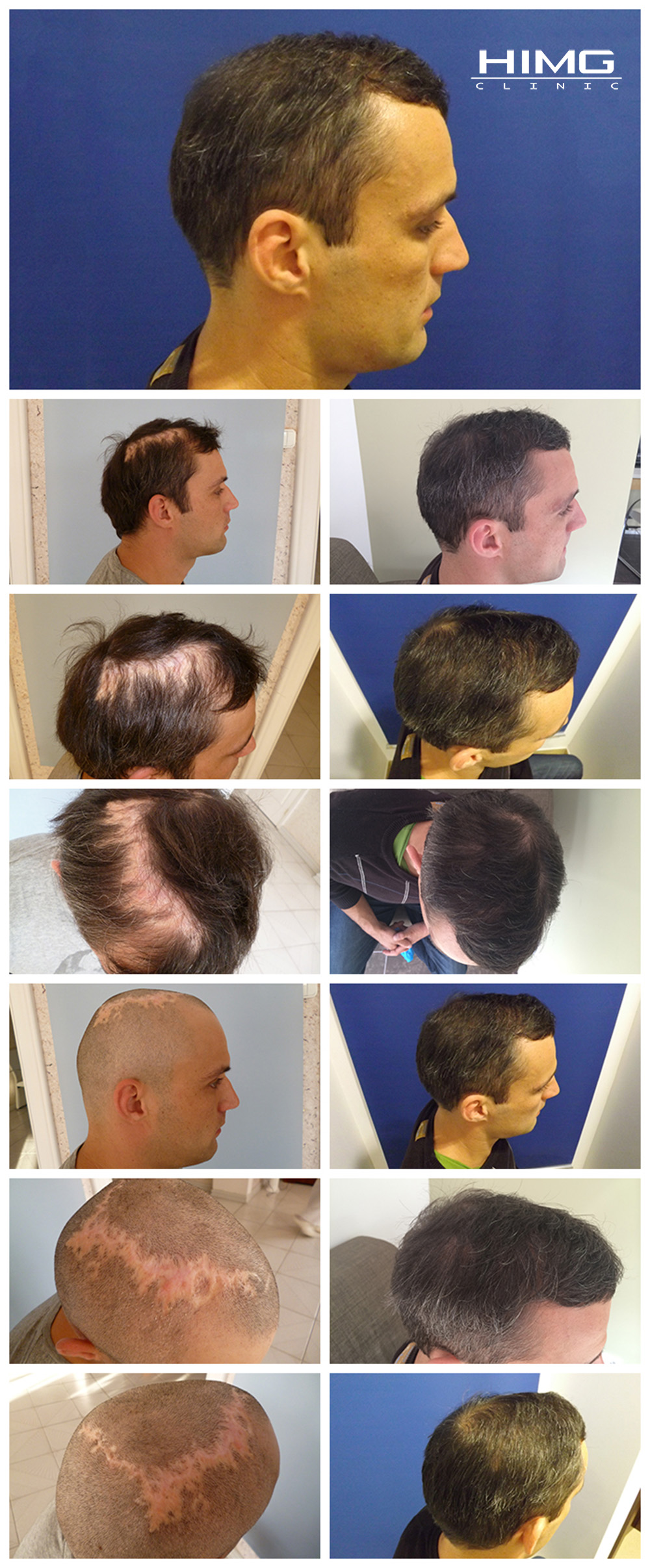 p-peter-hajbeultetes-elott-utan