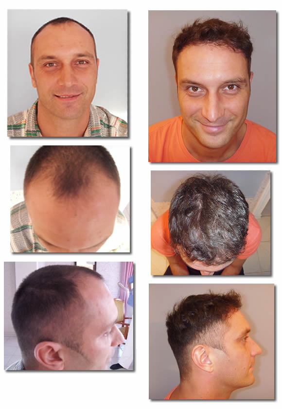 szebeni-istvan-hajbeultetes-elott-utan