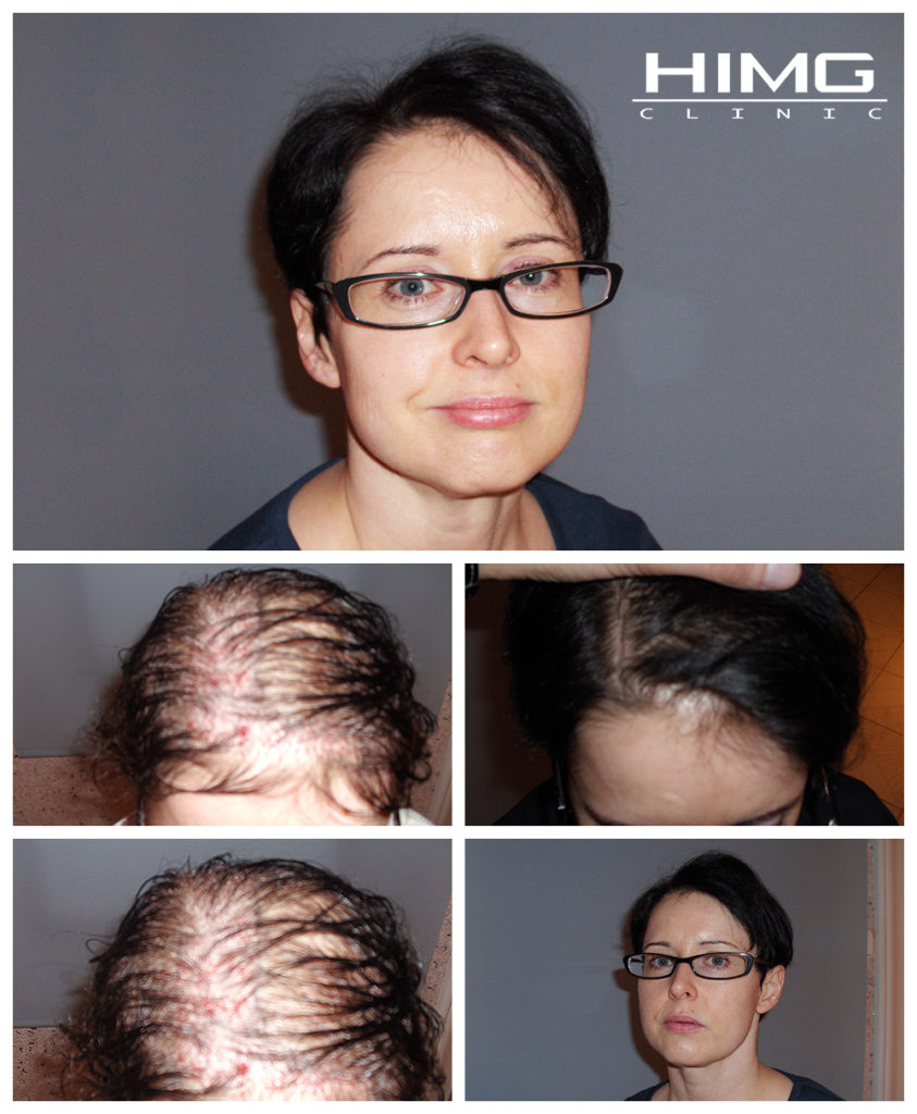 ujhelyi-zsuzsanna-noi-hajbeultetes-elotte-utana-kepek